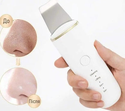 Epurateur de visage- lifting visage